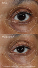 Charger l'image dans la galerie, Crème contour des yeux à la vitamine C⁺
